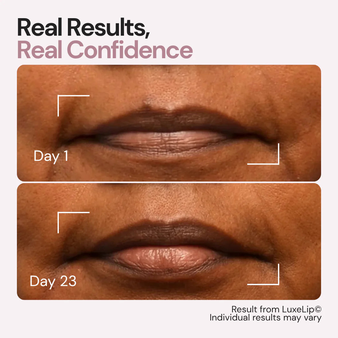 Aurolya Goodbye Lips Lines in Just 6 min a day