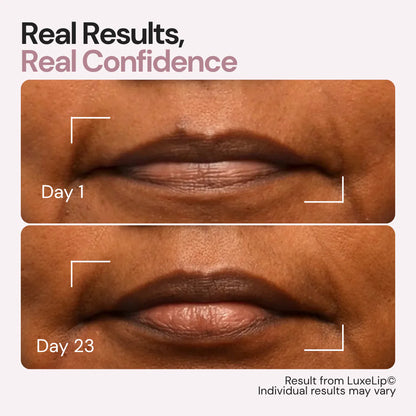 Aurolya Goodbye Lips Lines in Just 6 min a day