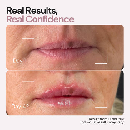 Aurolya Goodbye Lips Lines in Just 6 min a day