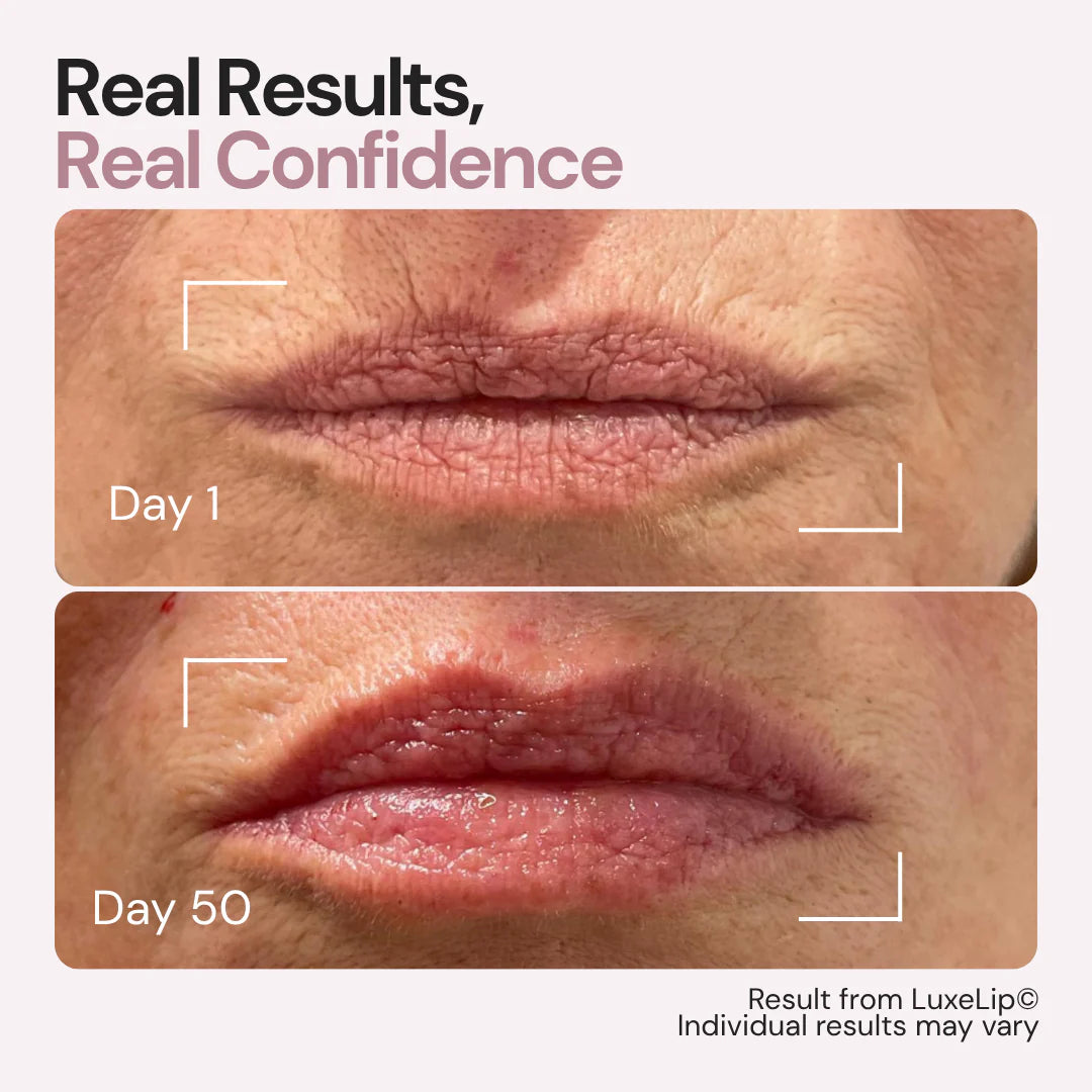 Aurolya Goodbye Lips Lines in Just 6 min a day