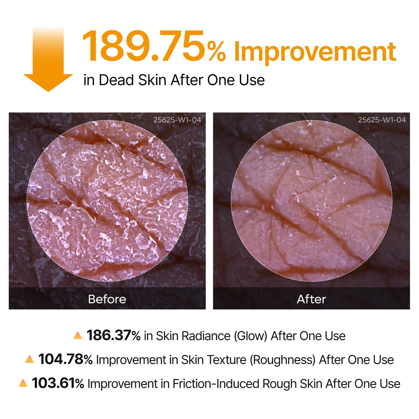 Aurolya Tumeric Peel Shot for Dead Skin & Keratosis Pilaris