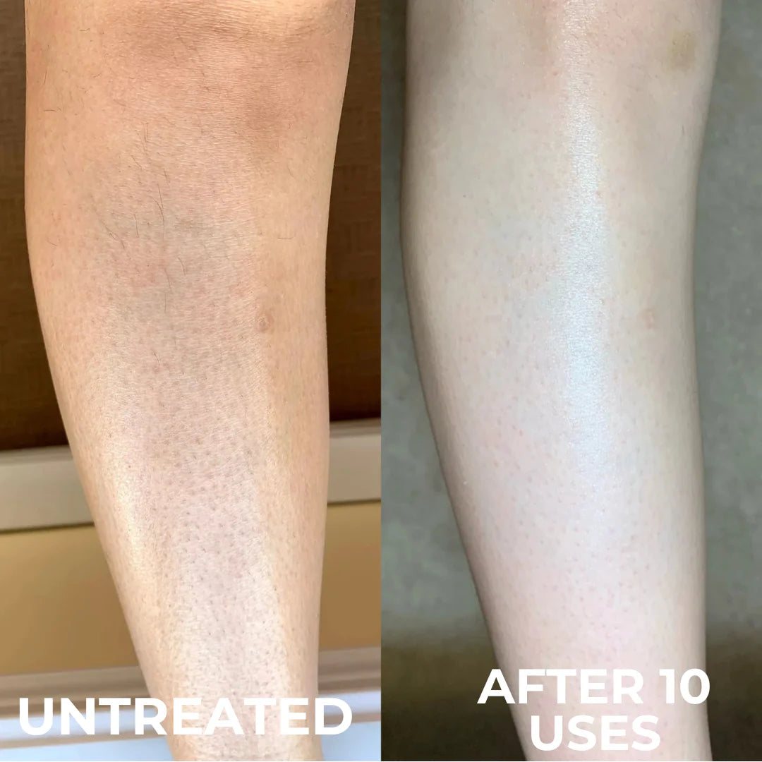 Aurolya Tumeric Peel Shot for Dead Skin & Keratosis Pilaris